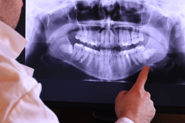 Best Emergency Root Canal Treatment in Cottage Grove, OR
